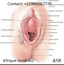 Soigner naturellement Mélanome vulvaire