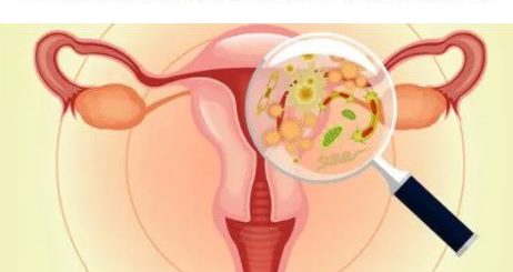 Phimosis Tubaire Occlusion Tubaire Traitement Naturel Phimosis Tubaire