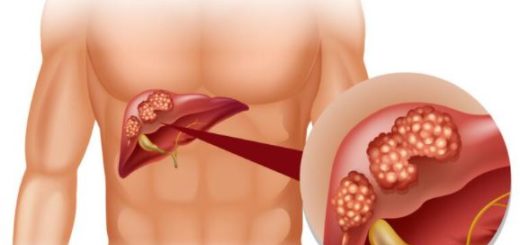 Hépatite B : Tout Savoir Sur Hépatite B