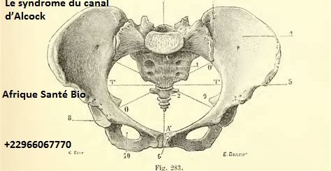 Le syndrome du canal d’Alcock