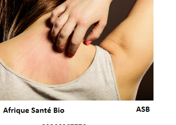 L'acanthosis nigricans