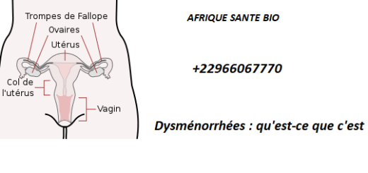 Dysménorrhées : qu'est-ce que c'est ?
