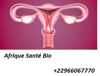 Produit naturel contre l'endométriose