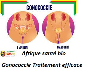 Gonococcie Traitement efficace