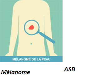 Mélanome: Causes traitements naturel