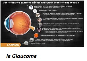 Comment guérir le Glaucome