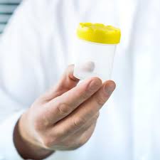 Causes, Symptômes et Traitement Naturel Hyperspermie: Hyperspermie est une condition dans laquelle un homme produit un plus grand quantité de sperme