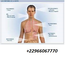 C'est quoi les symptômes de la grippe ?