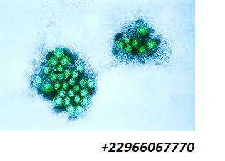 Symptômes du norovirus